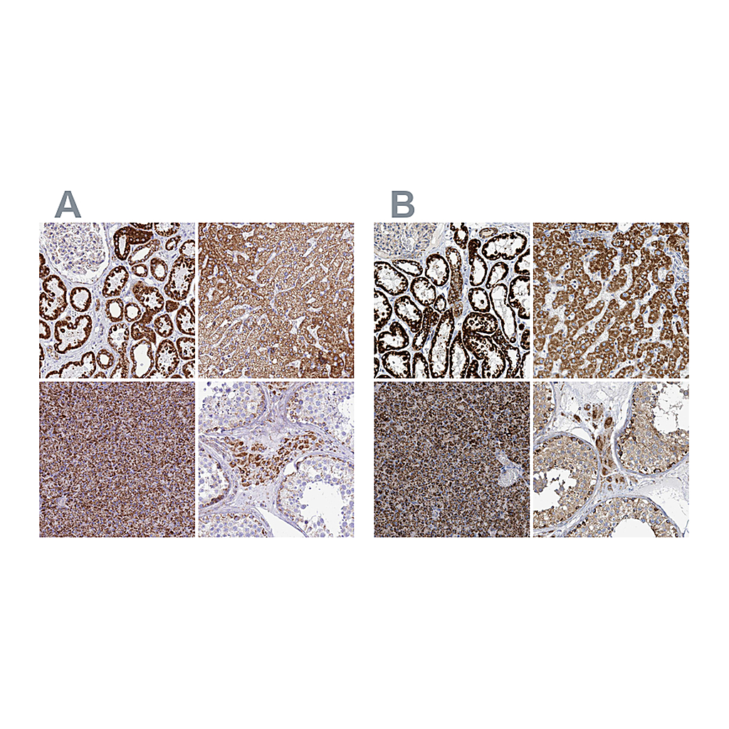Atlas Antibodies Anti-SUCLG2 Antibody