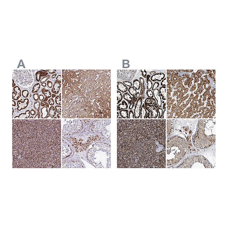Atlas Antibodies Anti-SUCLG2 Antibody