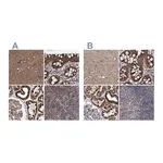 Atlas Antibodies Anti-SUCLA2 Antibody