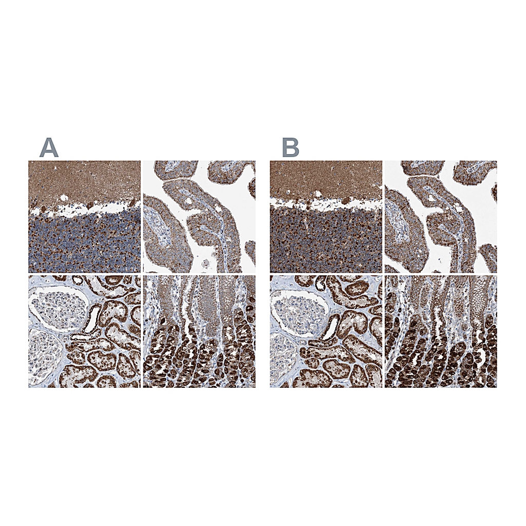 Atlas Antibodies Anti-SUCLG1 Antibody