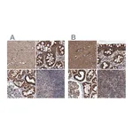 Atlas Antibodies Anti-SUCLA2 Antibody