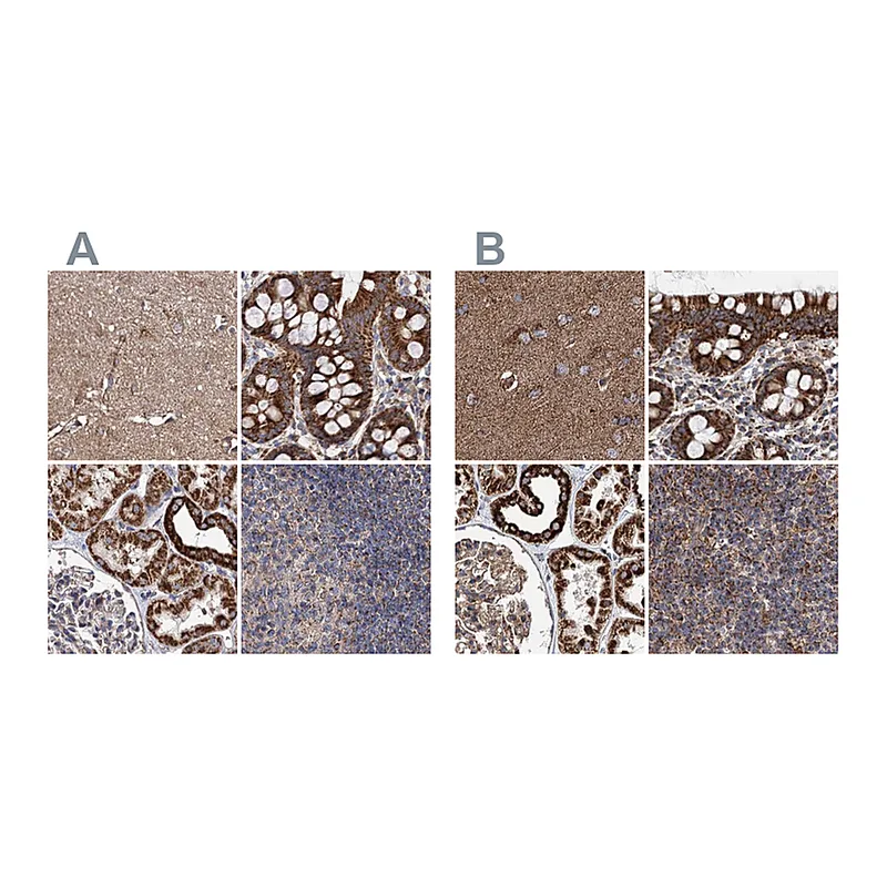 Atlas Antibodies Anti-SUCLA2 Antibody