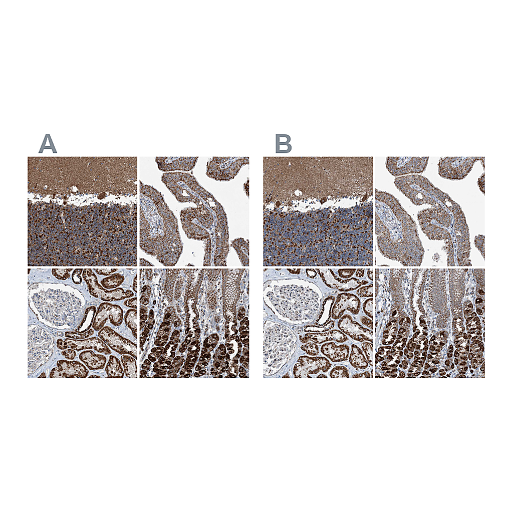 Atlas Antibodies Anti-SUCLG1 Antibody
