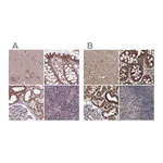 Atlas Antibodies Anti-SUCLA2 Antibody