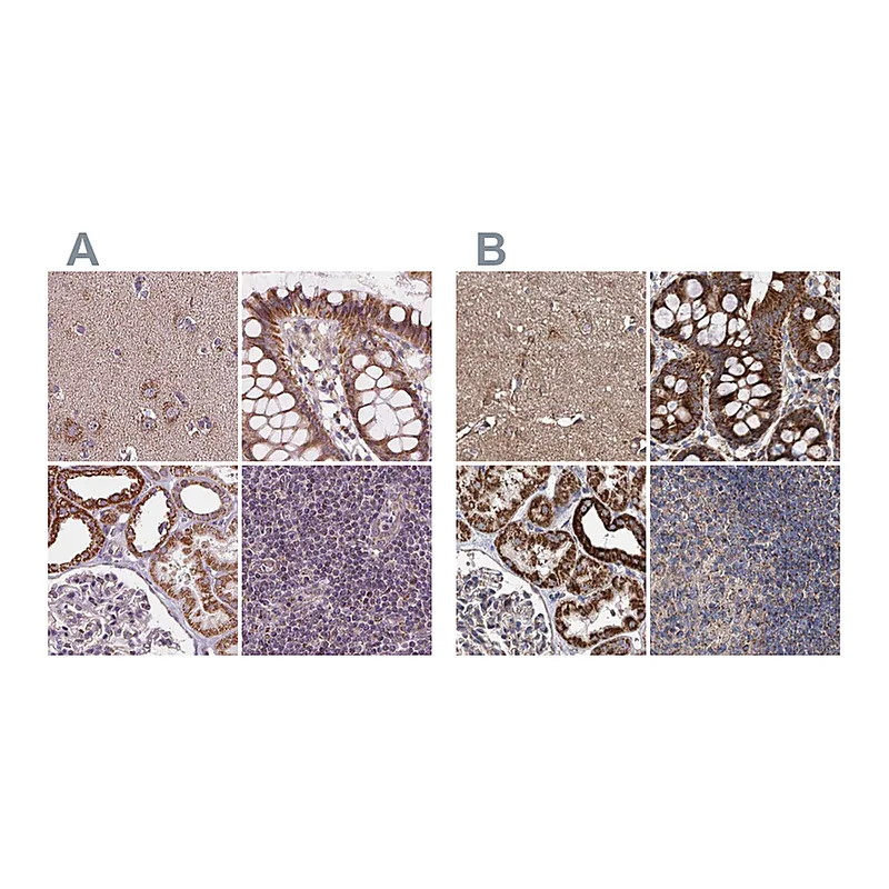 Atlas Antibodies Anti-SUCLA2 Antibody