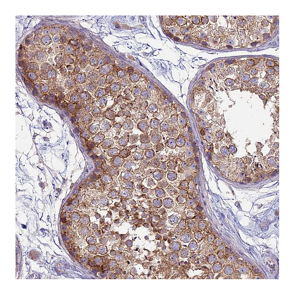 Atlas Antibodies Anti-SUCO Antibody