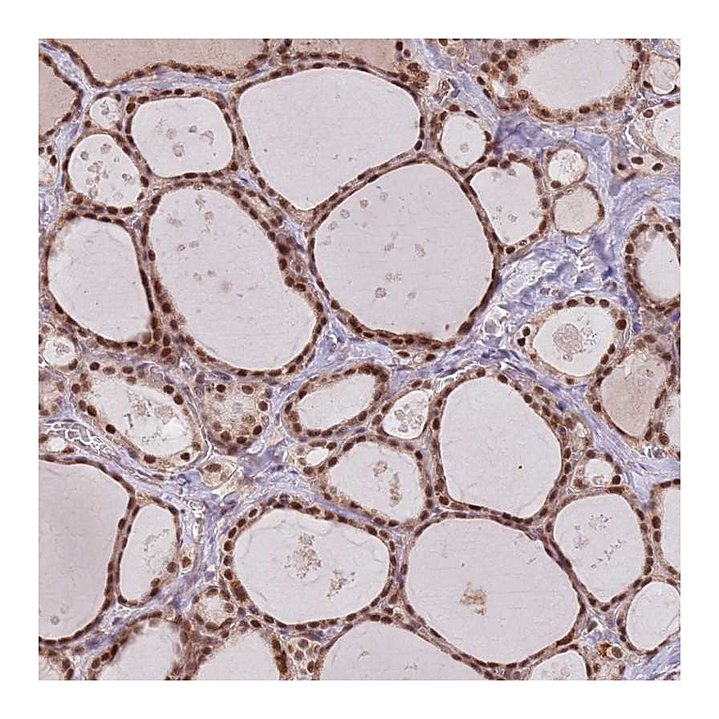 Atlas Antibodies Anti-SUDS3 Antibody