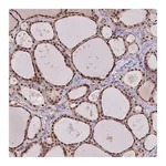 Atlas Antibodies Anti-SUDS3 Antibody