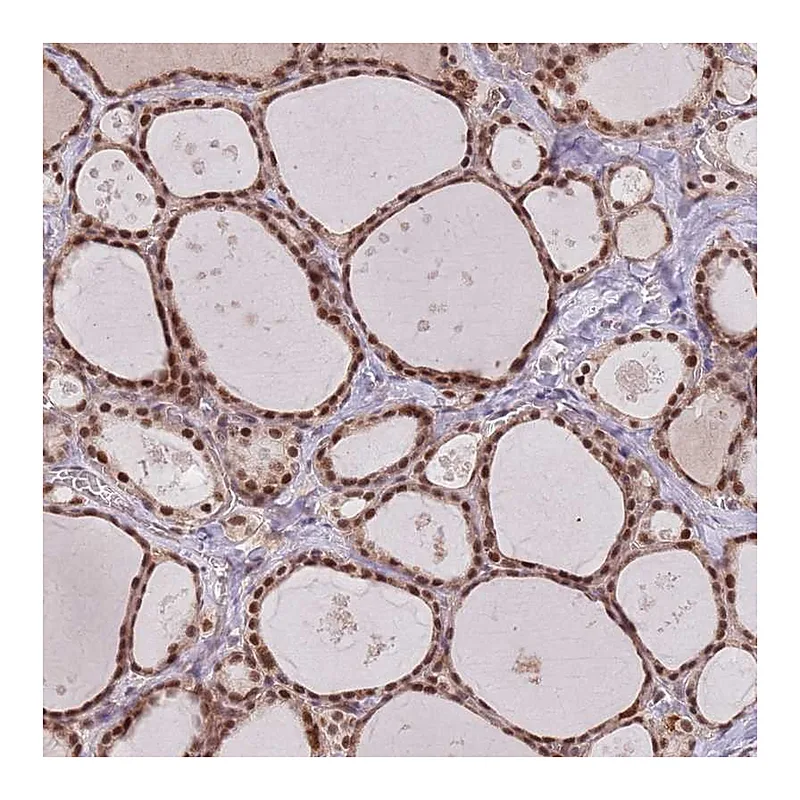 Atlas Antibodies Anti-SUDS3 Antibody
