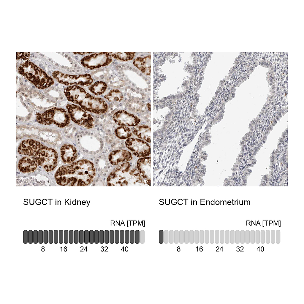 Atlas Antibodies Anti-SUGCT Antibody