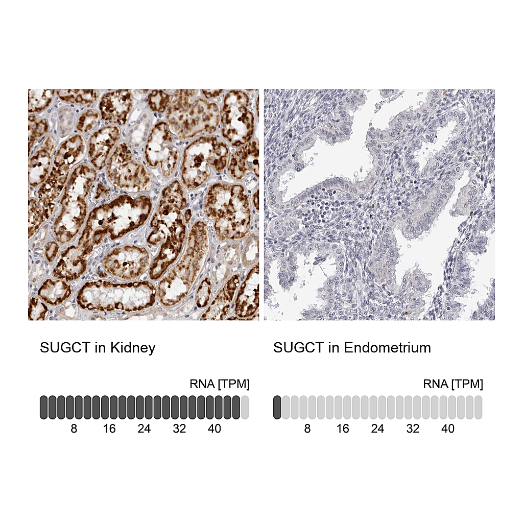 Atlas Antibodies Anti-SUGCT Antibody