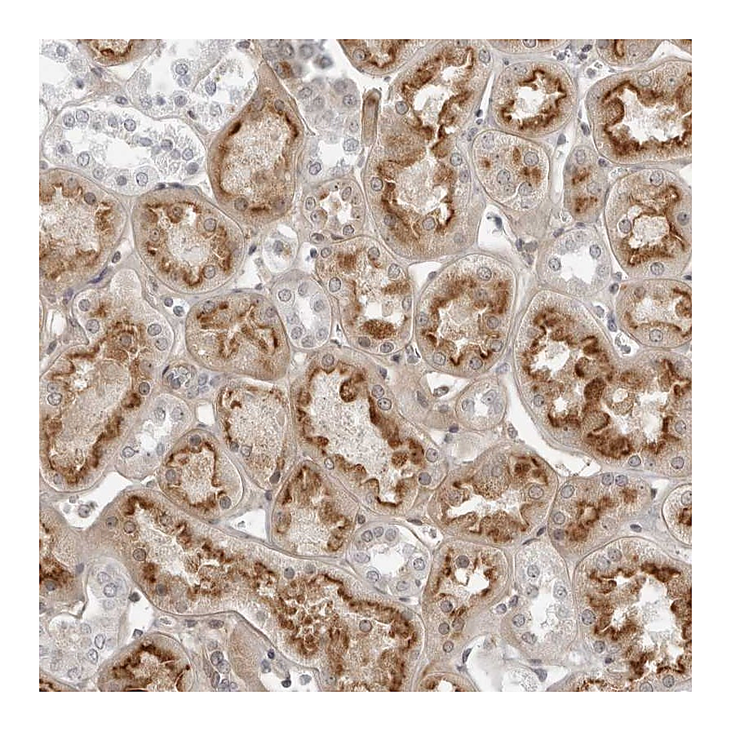 Atlas Antibodies Anti-SUGCT Antibody