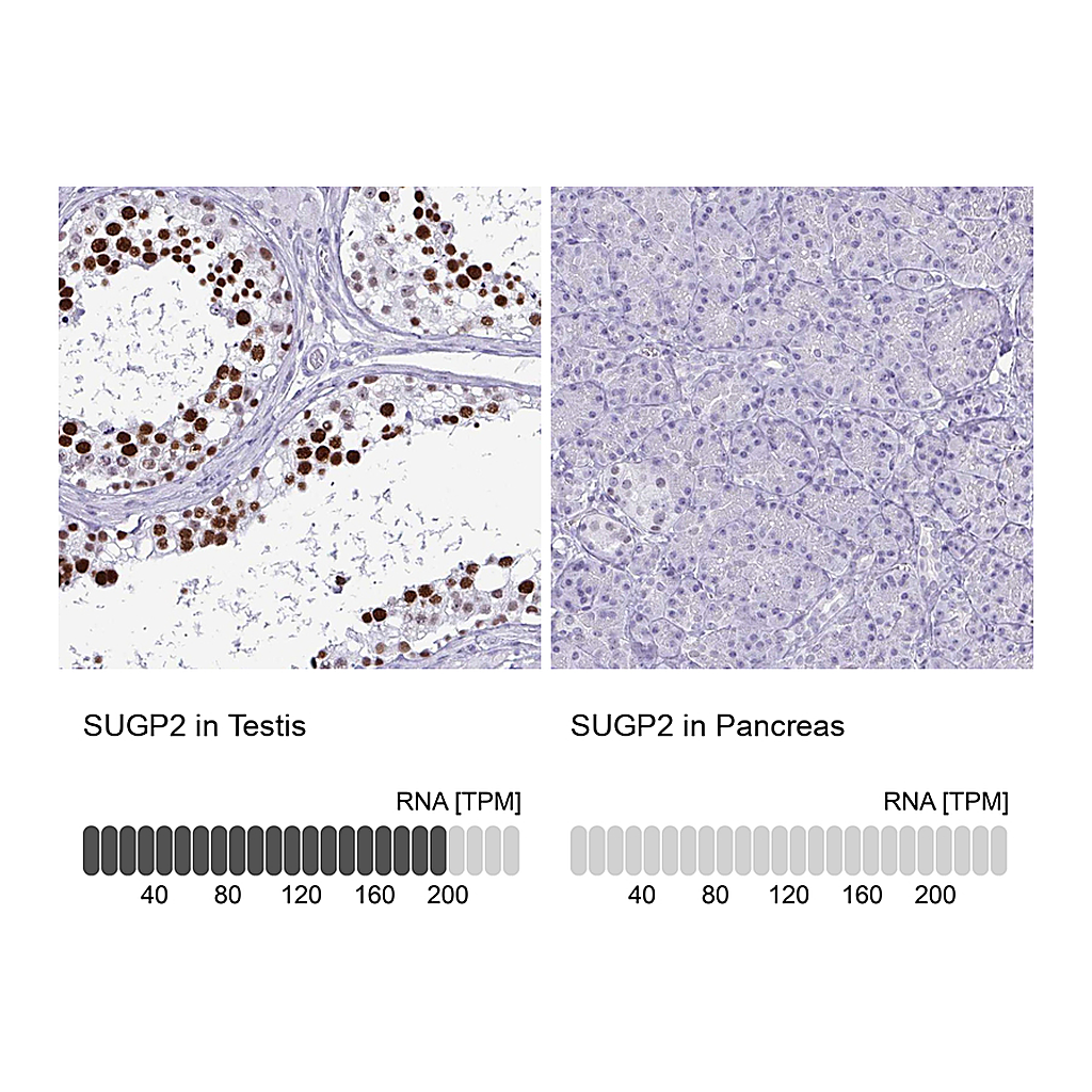 Atlas Antibodies Anti-SUGP2 Antibody
