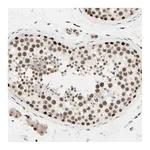 Atlas Antibodies Anti-SUFU Antibody