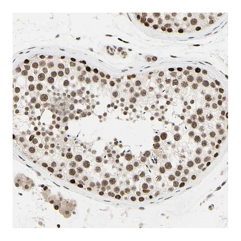 Atlas Antibodies Anti-SUFU Antibody