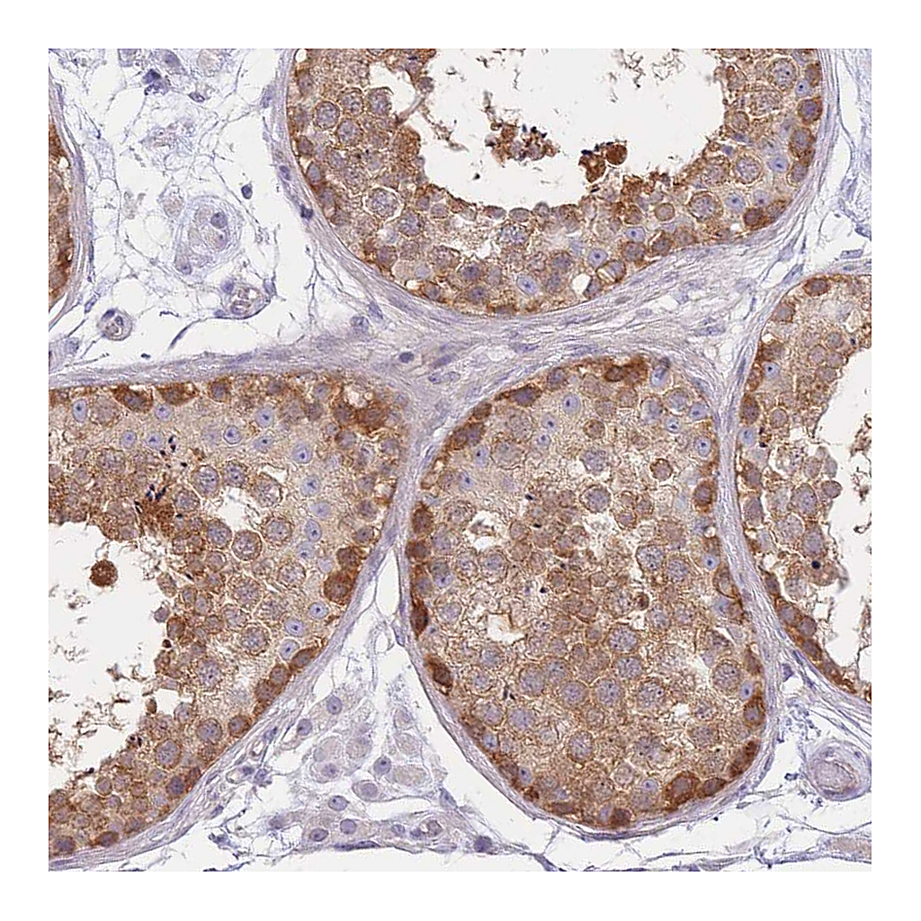 Atlas Antibodies Anti-SUGT1 Antibody