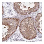 Atlas Antibodies Anti-SUGT1 Antibody