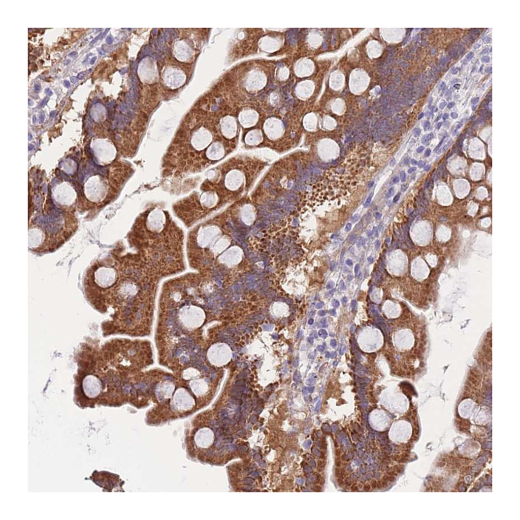 Atlas Antibodies Anti-SULT1A1 Antibody