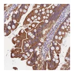 Atlas Antibodies Anti-SULT1A1 Antibody