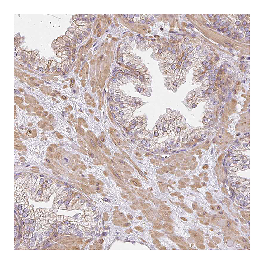 Atlas Antibodies Anti-SULF1 Antibody