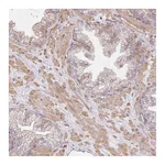 Atlas Antibodies Anti-SULF1 Antibody