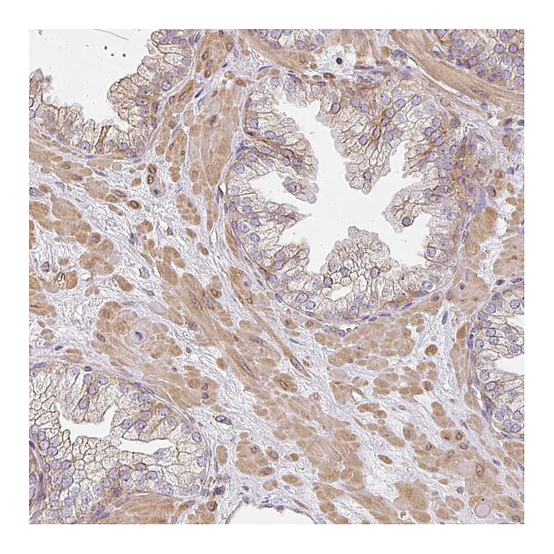 Atlas Antibodies Anti-SULF1 Antibody