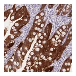 Atlas Antibodies Anti-SULT1A2 Antibody