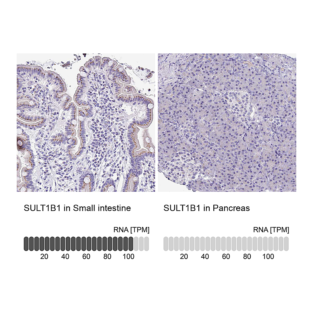 Atlas Antibodies Anti-SULT1B1 Antibody