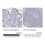 Atlas Antibodies Anti-SULT1B1 Antibody