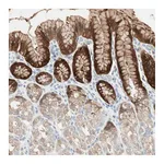 Atlas Antibodies Anti-SULT1C2 Antibody