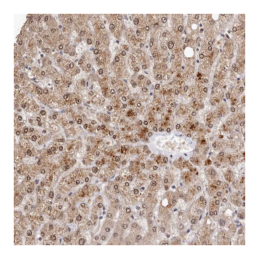 Atlas Antibodies Anti-SULT1E1 Antibody