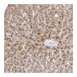 Atlas Antibodies Anti-SULT1E1 Antibody