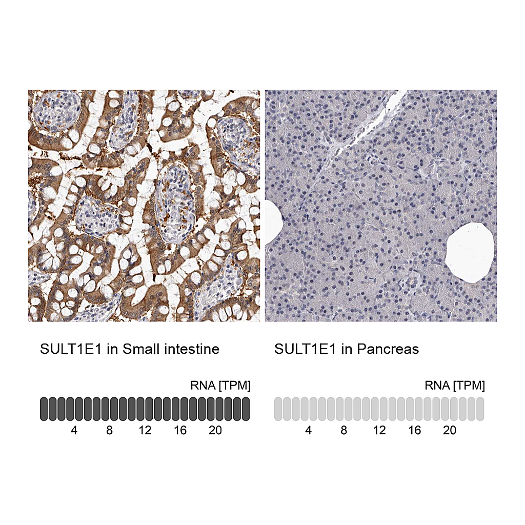 Atlas Antibodies Anti-SULT1E1 Antibody