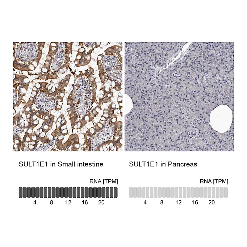 Atlas Antibodies Anti-SULT1E1 Antibody