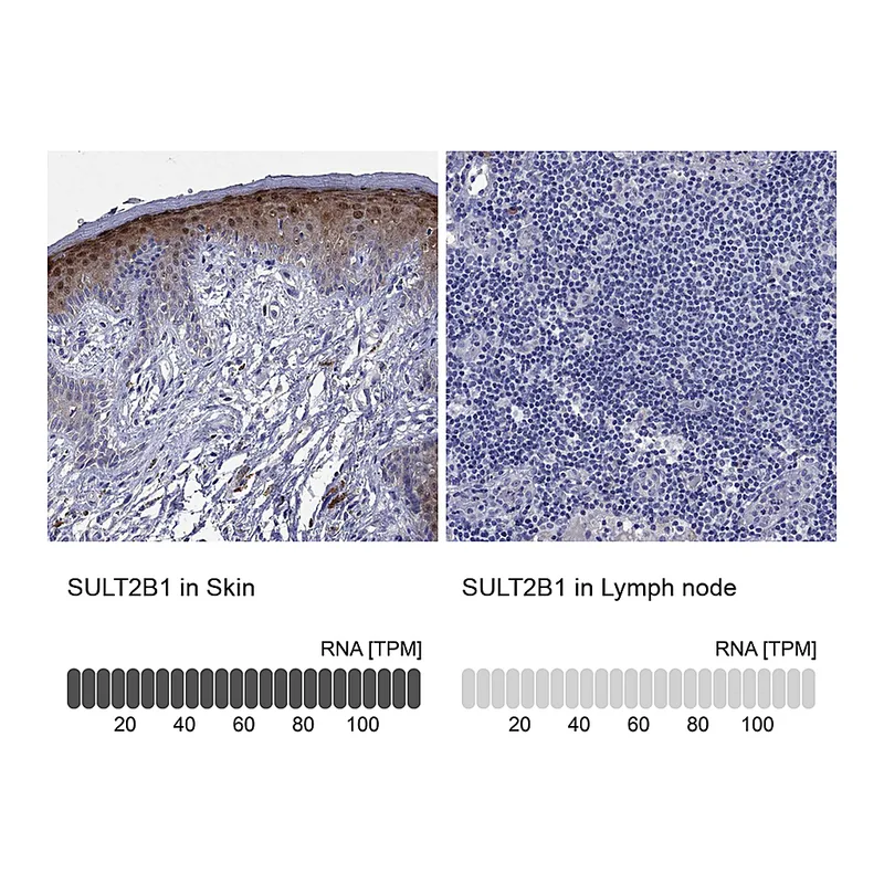 Atlas Antibodies Anti-SULT2B1 Antibody