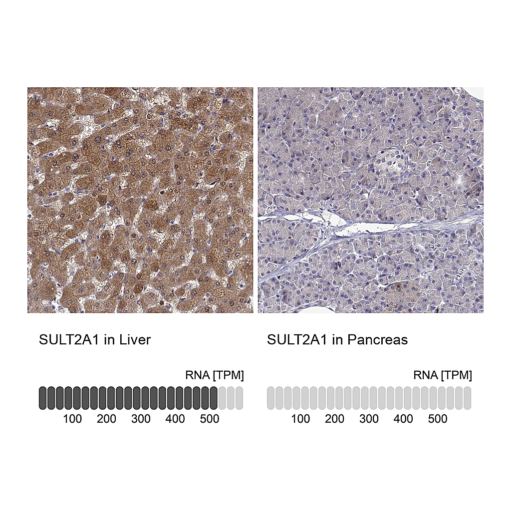 Atlas Antibodies Anti-SULT2A1 Antibody