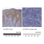 Atlas Antibodies Anti-SULT2B1 Antibody
