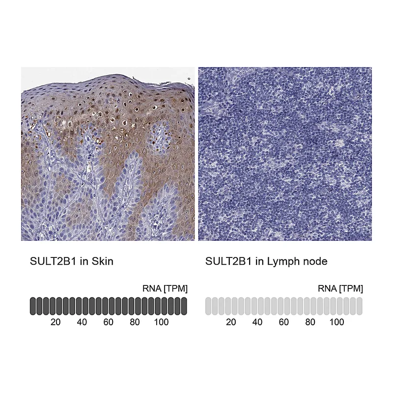Atlas Antibodies Anti-SULT2B1 Antibody
