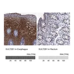 Atlas Antibodies Anti-SULT2B1 Antibody