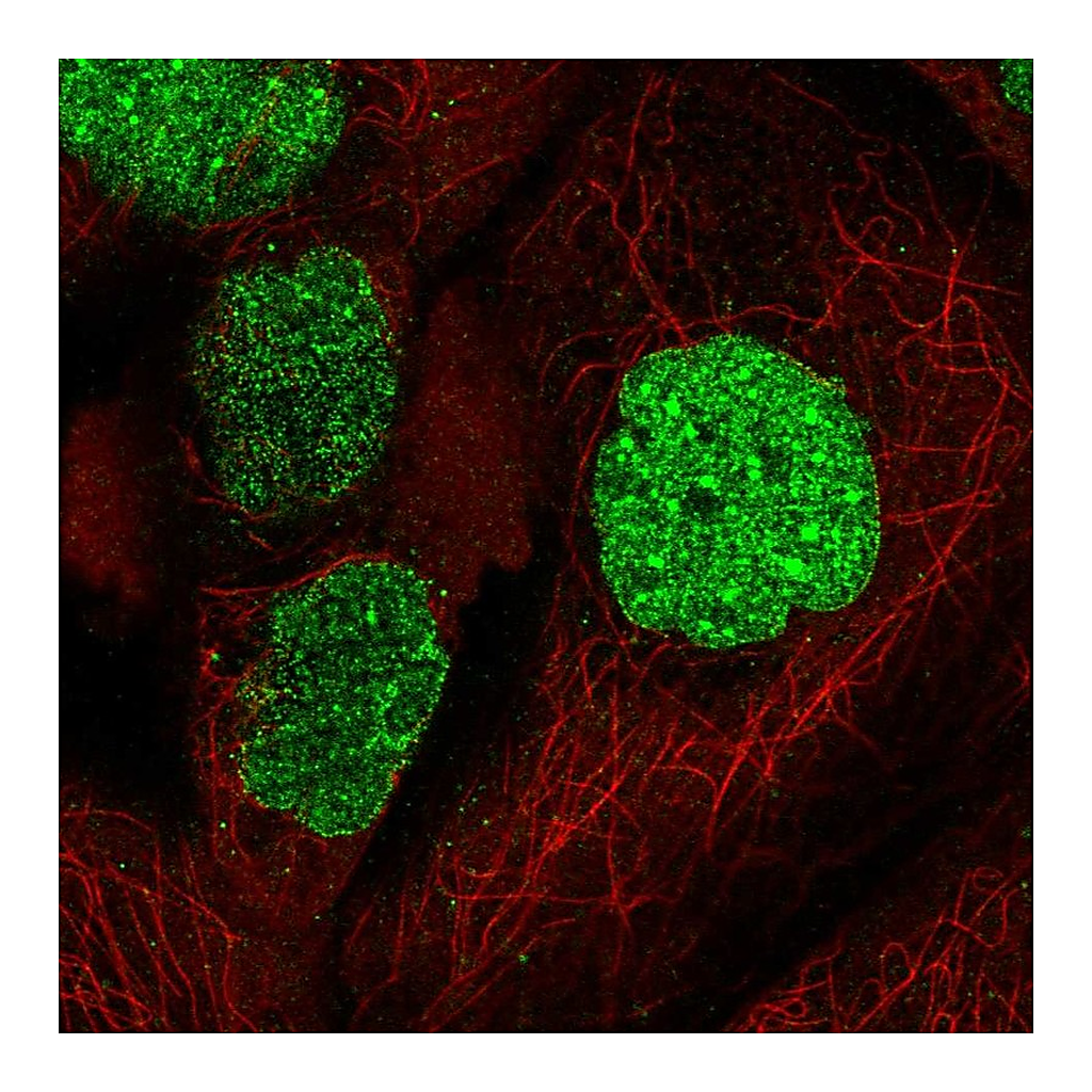 Atlas Antibodies Anti-SUMO1 Antibody