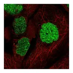 Atlas Antibodies Anti-SUMO1 Antibody