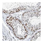 Atlas Antibodies Anti-SUMO2 Antibody