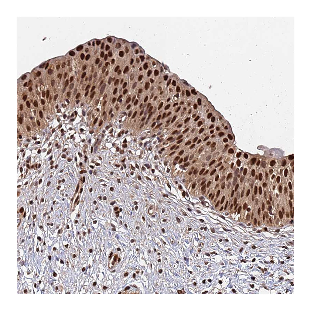 Atlas Antibodies Anti-SUMO2 Antibody