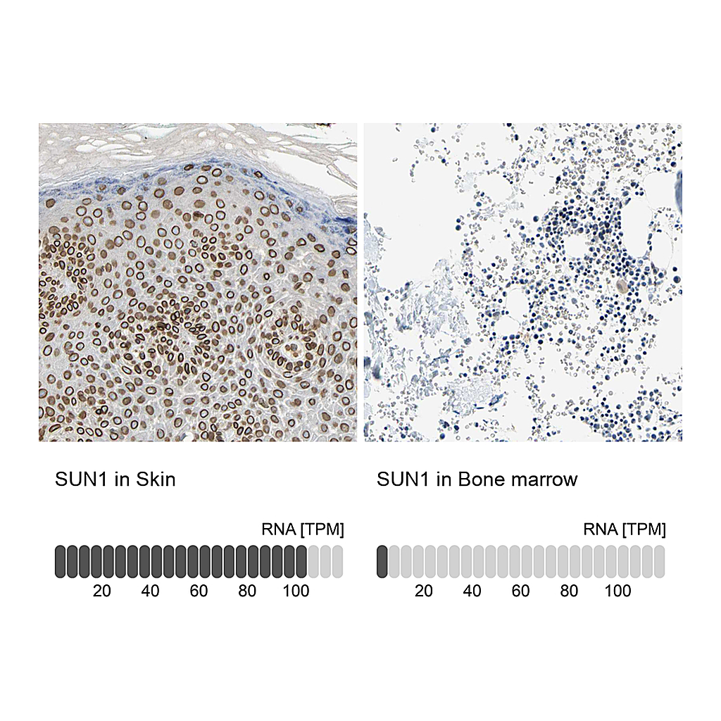 Atlas Antibodies Anti-SUN1 Antibody