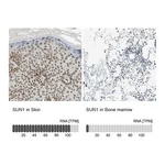 Atlas Antibodies Anti-SUN1 Antibody