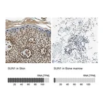 Atlas Antibodies Anti-SUN1 Antibody