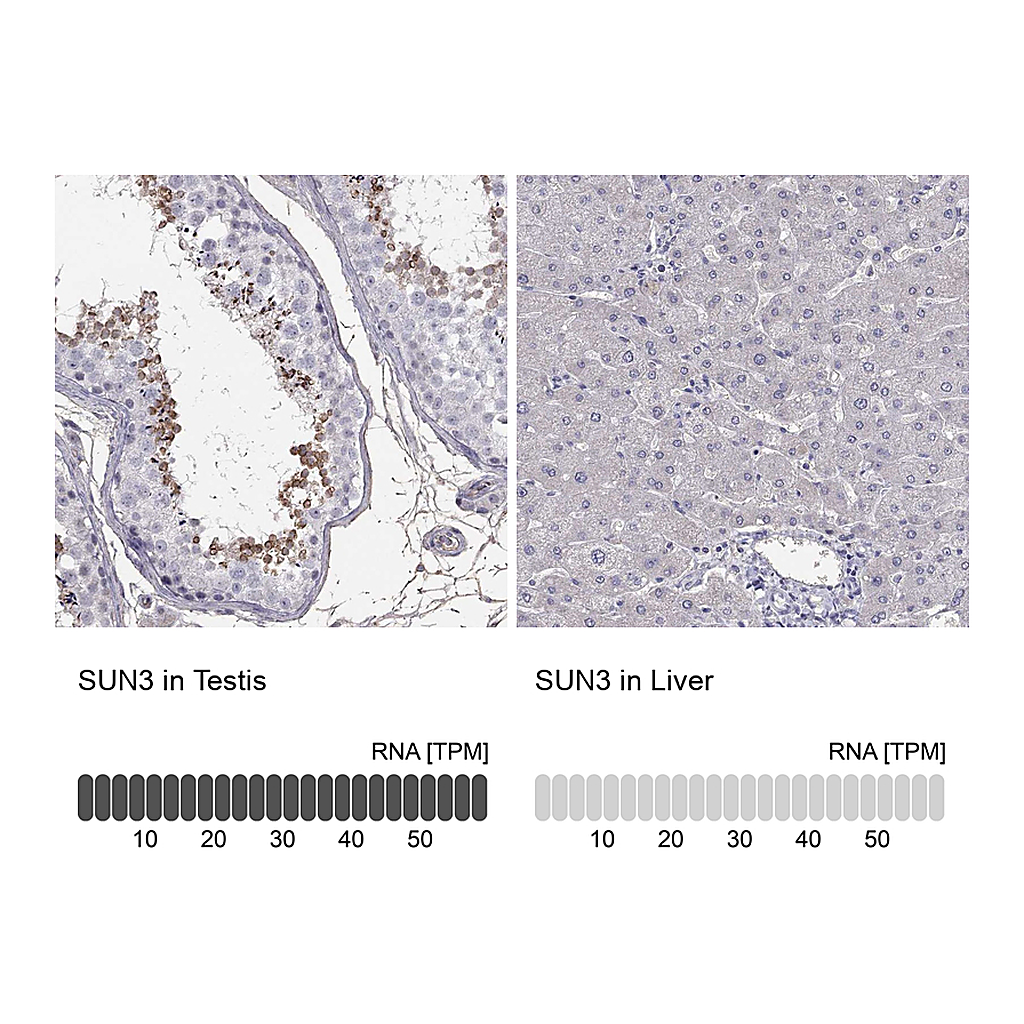 Atlas Antibodies Anti-SUN3 Antibody
