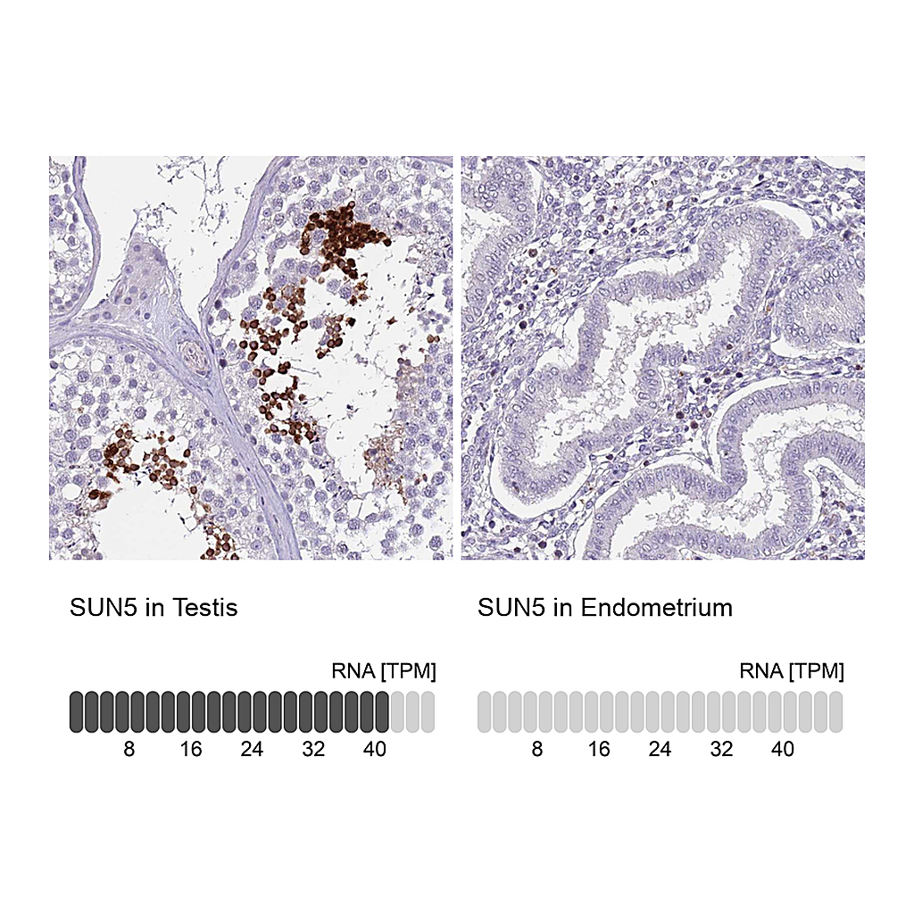 Atlas Antibodies Anti-SUN5 Antibody