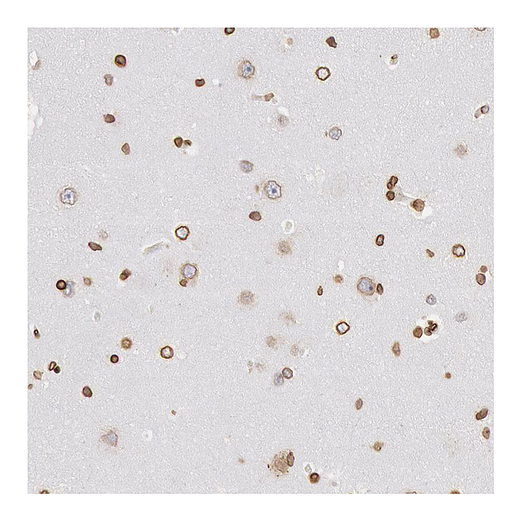Atlas Antibodies Anti-SUN2 Antibody