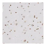 Atlas Antibodies Anti-SUN2 Antibody